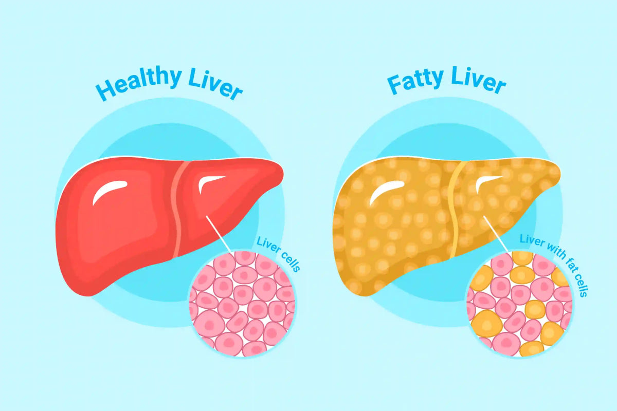 Understanding Liver Detox Supplements: Benefits, Ingredients, & Risk – Genetic Nutrition